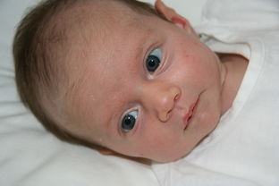 怀孕妊娠合并新生儿红细胞增多症怎么部分换血? 怀孕妊娠合并新生儿红细胞增多症怎么部分换血?